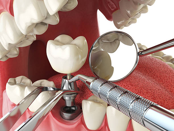 Best Emergency Denture Repair in Tracy City, TN